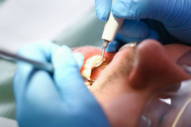 Best Urgent Tooth Repair  in Hickory Hls, IL